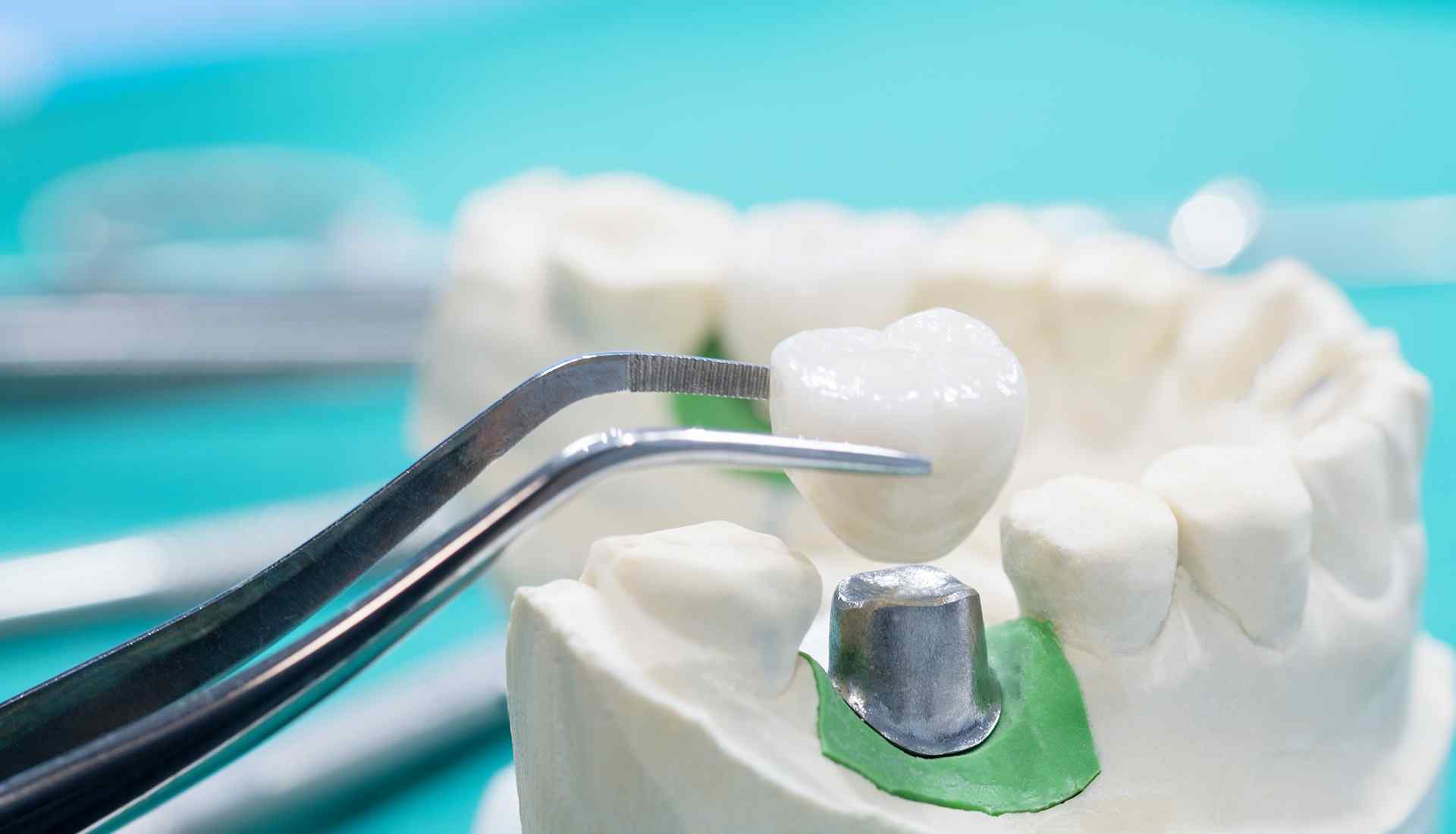 https://eurodentaloxford.co.uk/wp-content/uploads/2020/01/featured_image_shop_two_columns.jpg