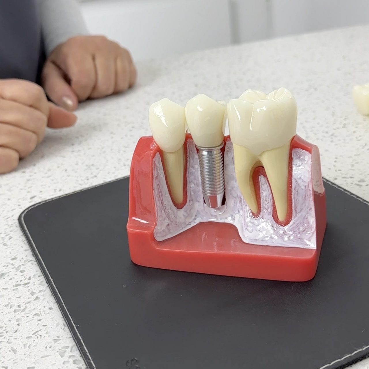 https://eurodentaloxford.co.uk/wp-content/uploads/2025/03/39-1280x1280.jpg